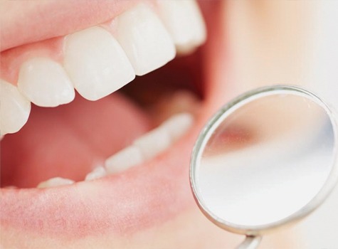 SE Cosmetic Dentistry | East Dental Care | SE Calgary Dentist
