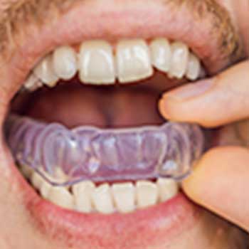 Custom Sports Mouthguard | East Dental Care | General Dentist Calgary AB
