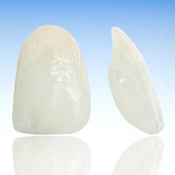 Calgary Porcelain Venners | East Dental Care | General Dentist | 17 Ave SE Calgary