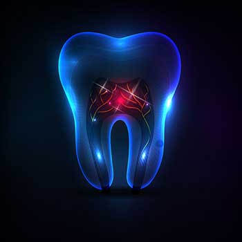 Root Canal Therapy Calgary | East Dental Care | General Dentist | 17 Ave SE | Calgary