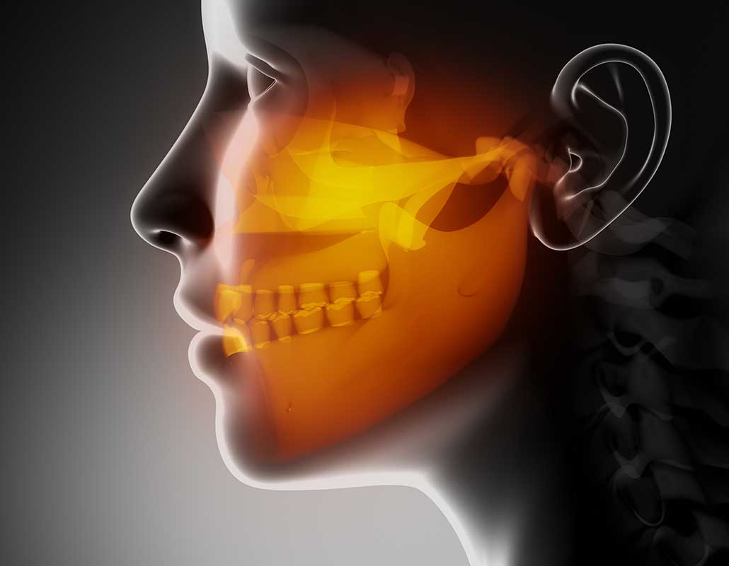 Calgary TMJ/TMD | East Dental Care | General Dentist | SE Calgary